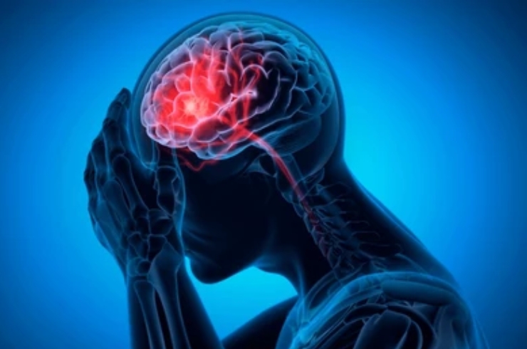 Limb-related Neurological Conditions-----16